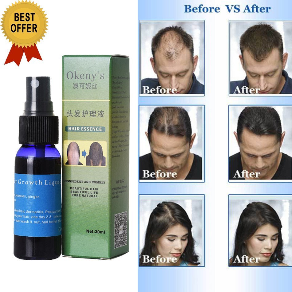 VolumON Haarwuchs-Spray – 100% Natürliche Pflanzliche Formel, 3 X 60 Ml (3 Monatsvorrat)