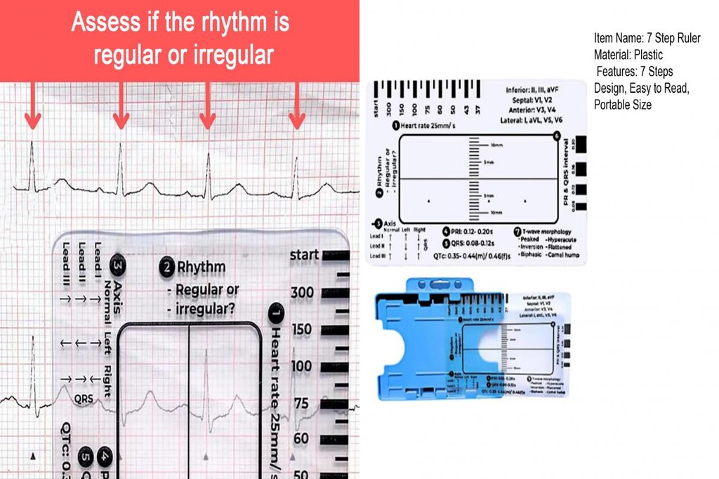livecity| Professional 7 Step Ruler Easy-to-read Ekg Reference Card ...