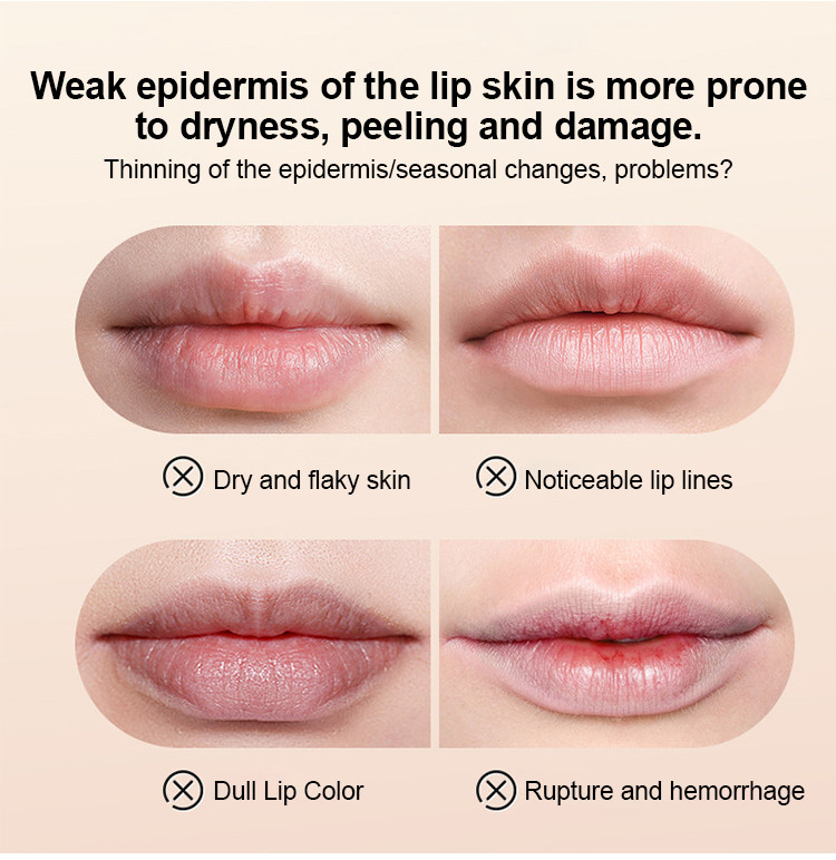 Discolored Lip Essence Oil Desalinates Lip Lines, Waterproof ...
