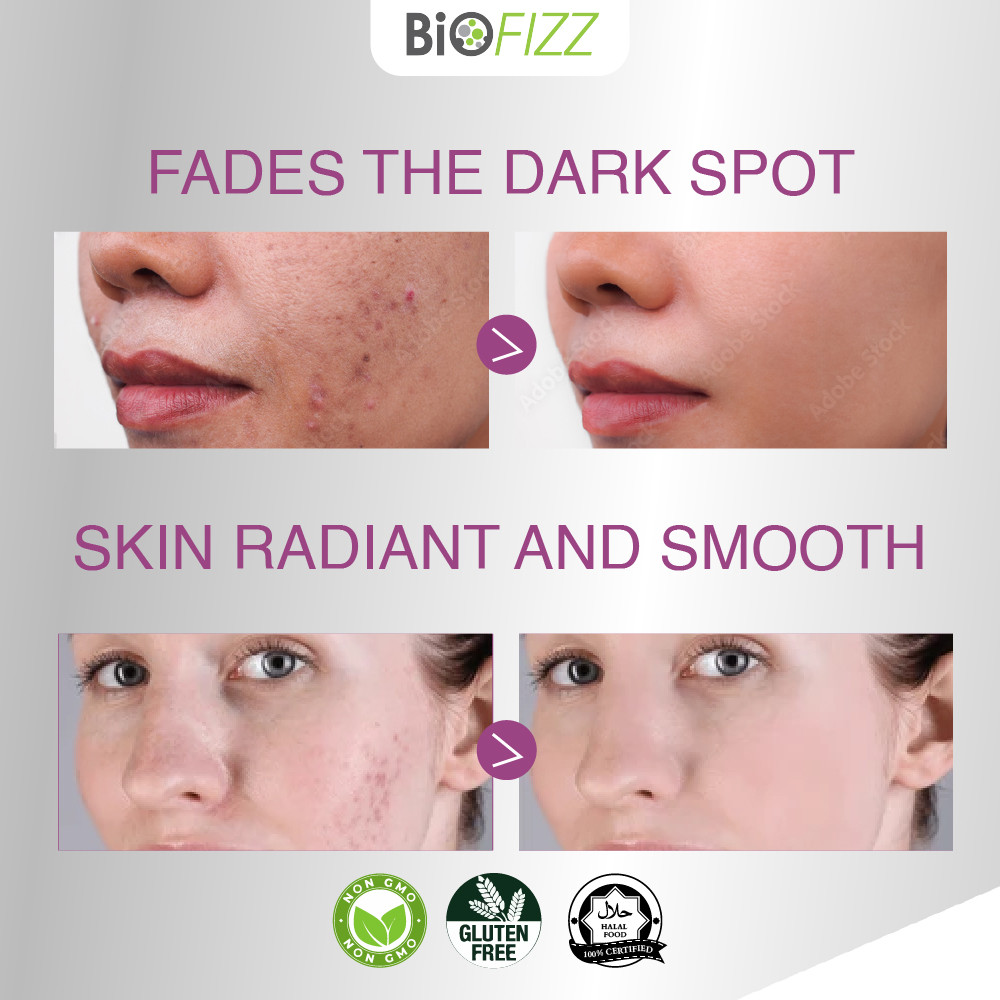 BIOFIZZ Halal Bliss Black Seed Gummy Boost Immunity Skin Lightening ...