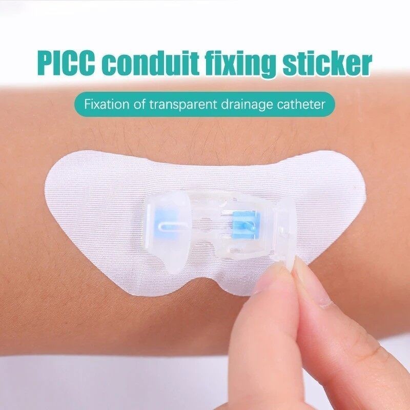 Medical Catheter Fixation Patch Body Surface Catheter Fixation Device ...