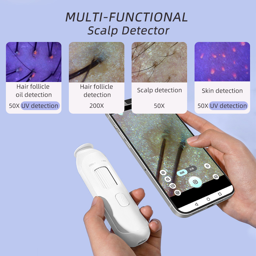 HD Scalp Analyzer Hair Detector Camera - USB Portable Microscope Hair ...