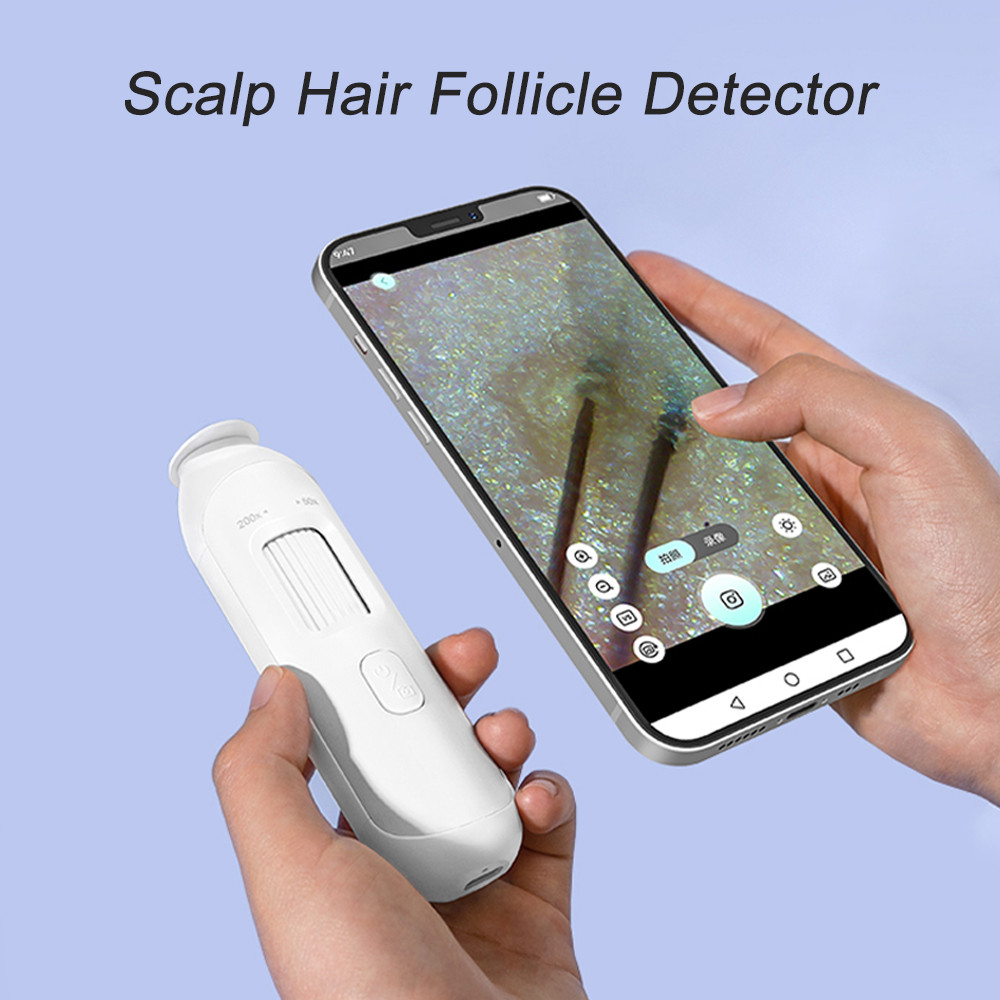 HD Scalp Analyzer Hair Detector Camera - USB Portable Microscope Hair ...