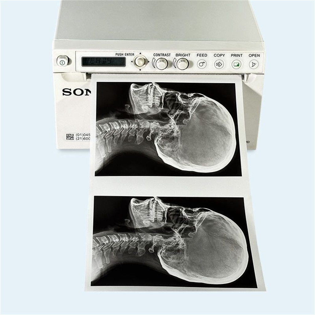 UPP-110HG High Glossy Ultrasound Thermal Paper Medical Ultrasound Paper ...