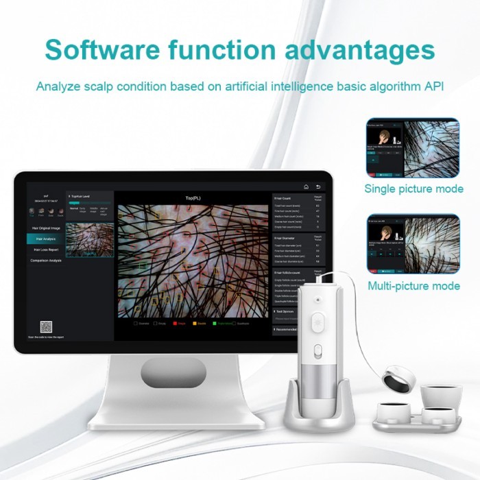 AI Intelligent Analysis Hair Tester Skin Analyzer Analysis Scalp Care ...
