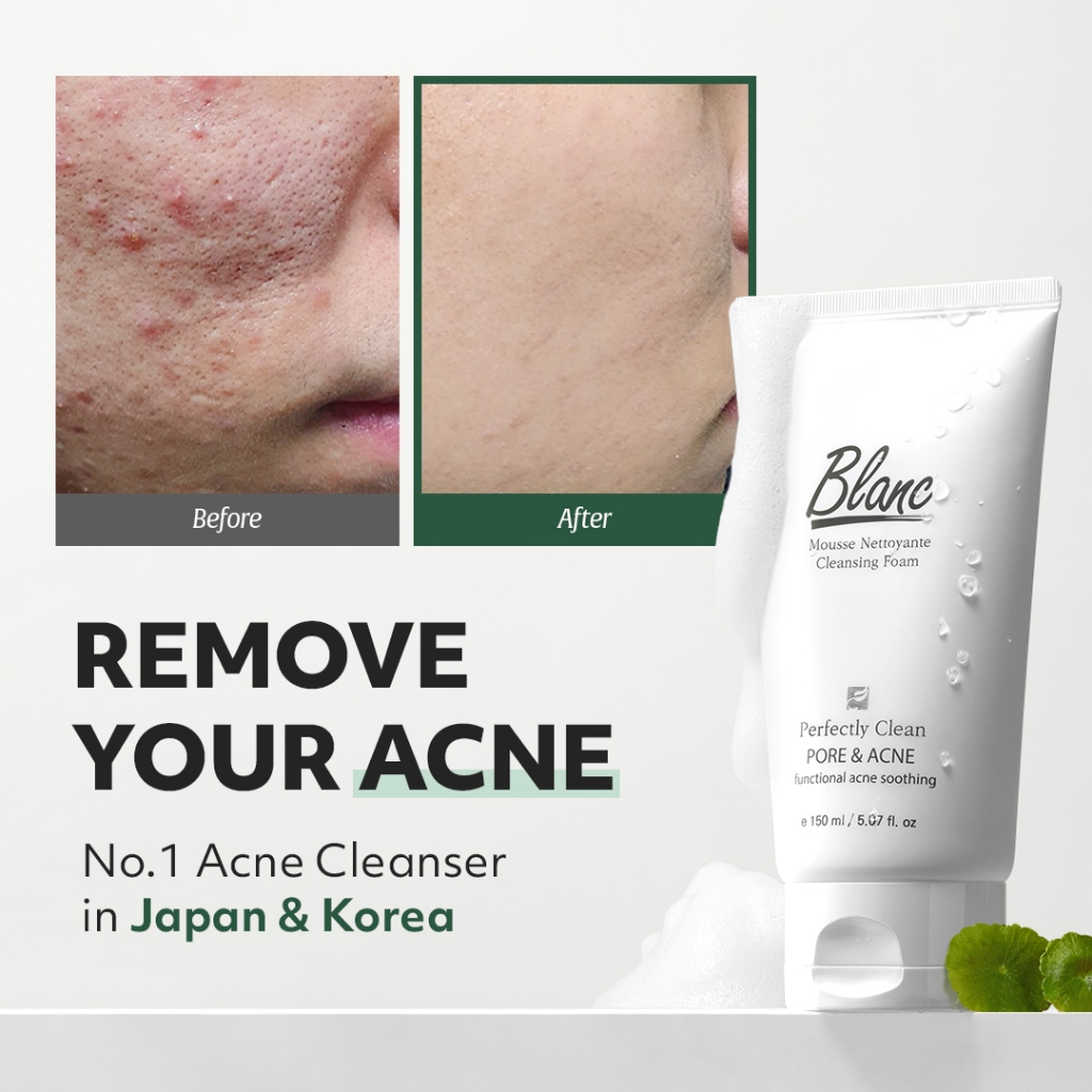 Blanc Nature Official Acne Pimple Cleanser 150ml Jeju Orgarnic Green tea Salicylic Acid Acne