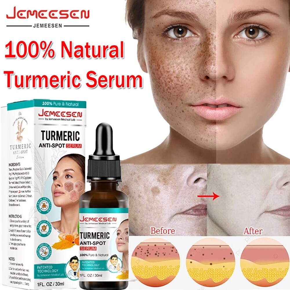 View of Expert-recommended products to help you avoid inflammatory acne - Curology