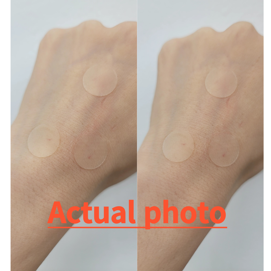 [KOREA] 🇰🇷 Authentic⭐70pcs Hydrocolloid Mosquito bite Wound Acne Pimple Patch Waterproof