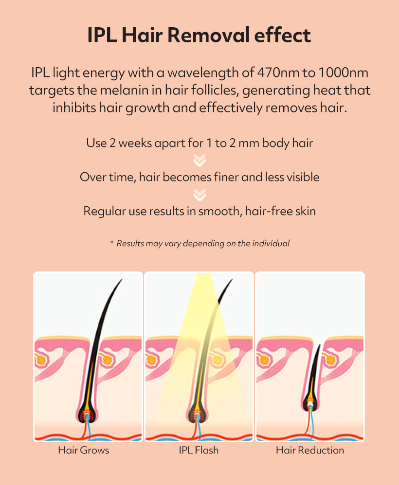 eosika SIPL-2000M IPL Laser Hair Removal Device With 3 Lamp Cartridges ...