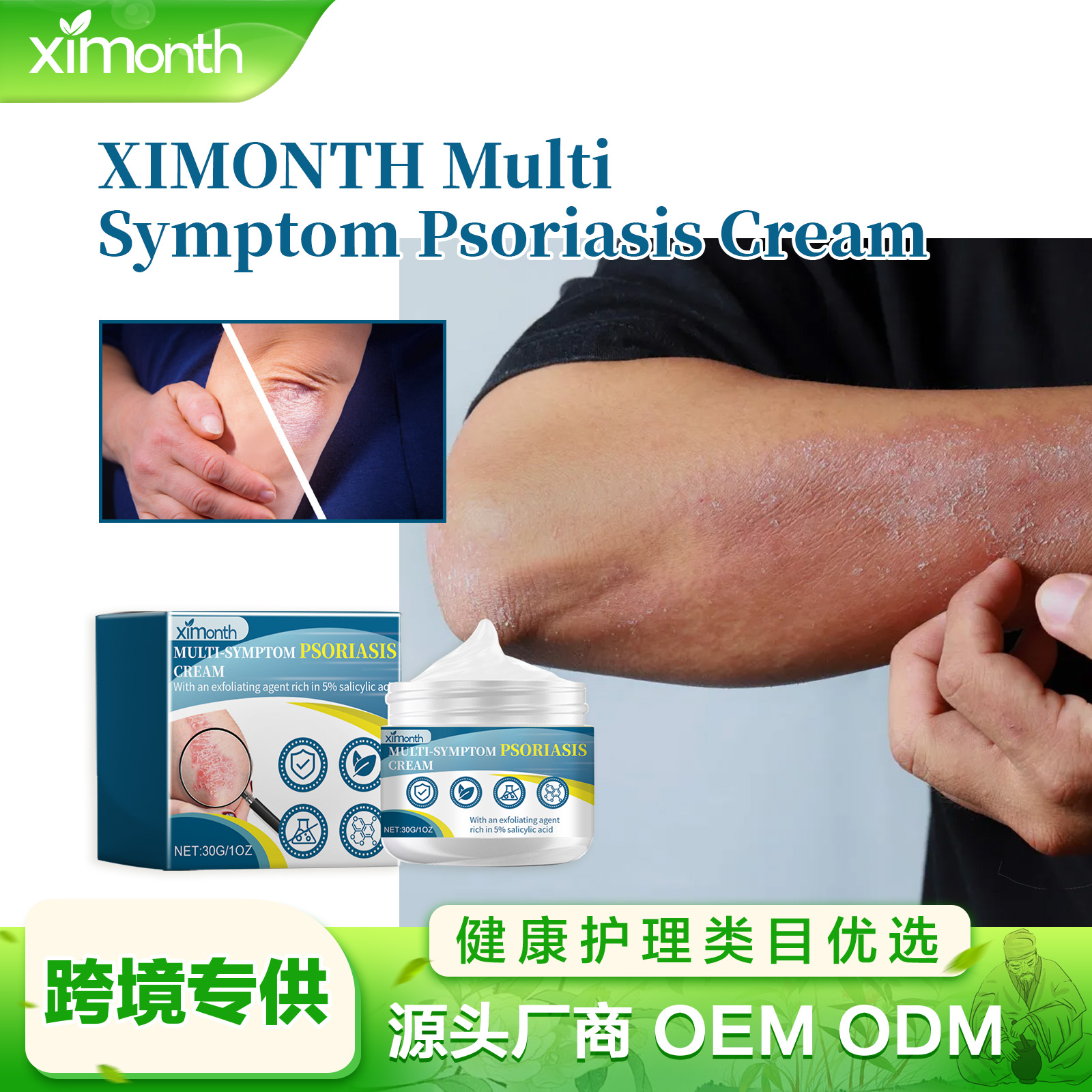 Multi-Symptom Psoriasis Ointment - Antibacterial, Anti-Itchy Cream for ...