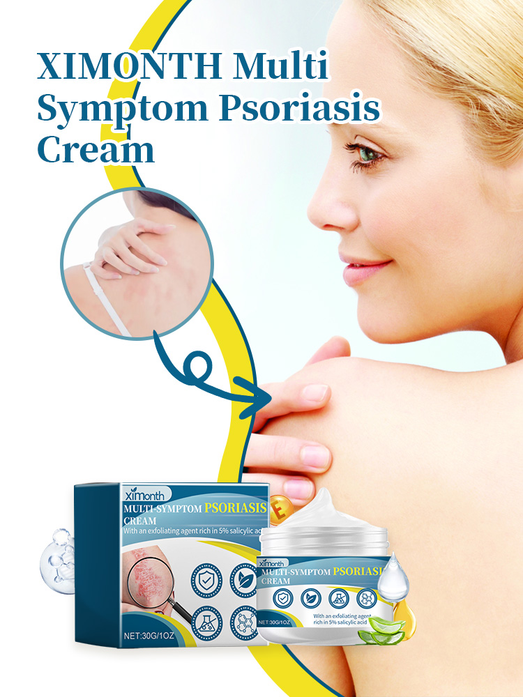Multi-Symptom Psoriasis Ointment - Antibacterial, Anti-Itchy Cream for ...