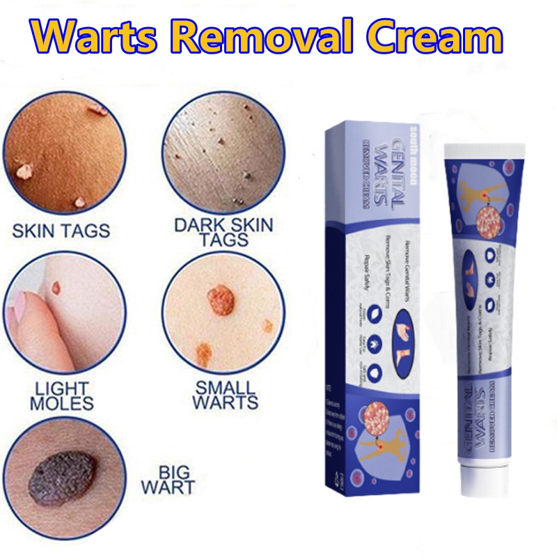 Ubat Buang Kutil Ketuat Tahi Lalat Biji Kolestrol Mole Removal Wart Cream Wart Removal Ointment