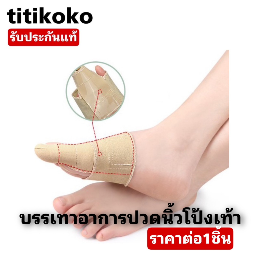 Thumbs Relieve The Pain Of The Feet. Reduce Friction When Wearing Shoes 