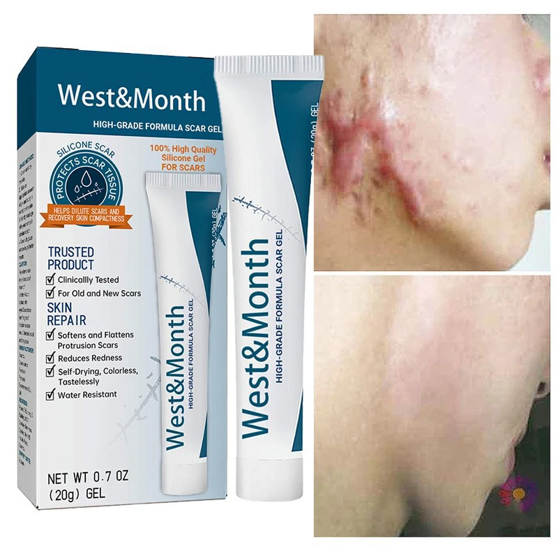 Scar Removal Cream Cesarean Section Smooth Skin Treatment Shopee Malaysia