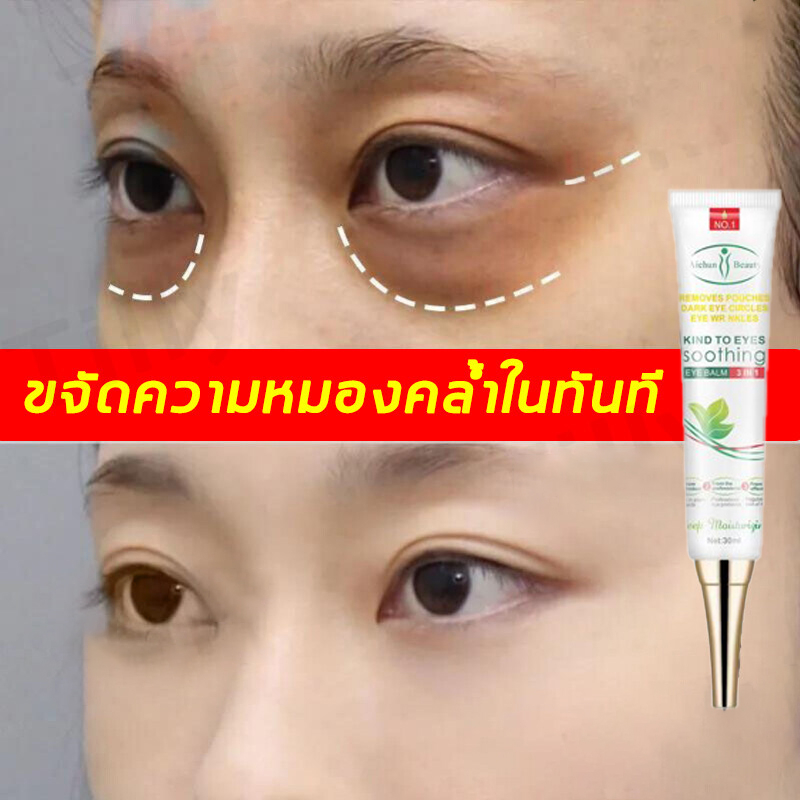 Aichun Fat Granules 30ml Remove Dark Circles Swelling Under The Eyes