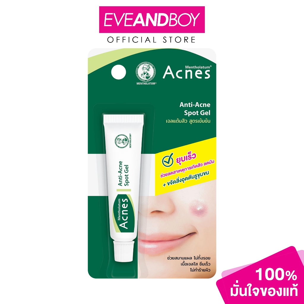 MENTHOLATUM ACNES Sealing Jell (Acne Treatment Gel) (5g Acne Pimple Gel