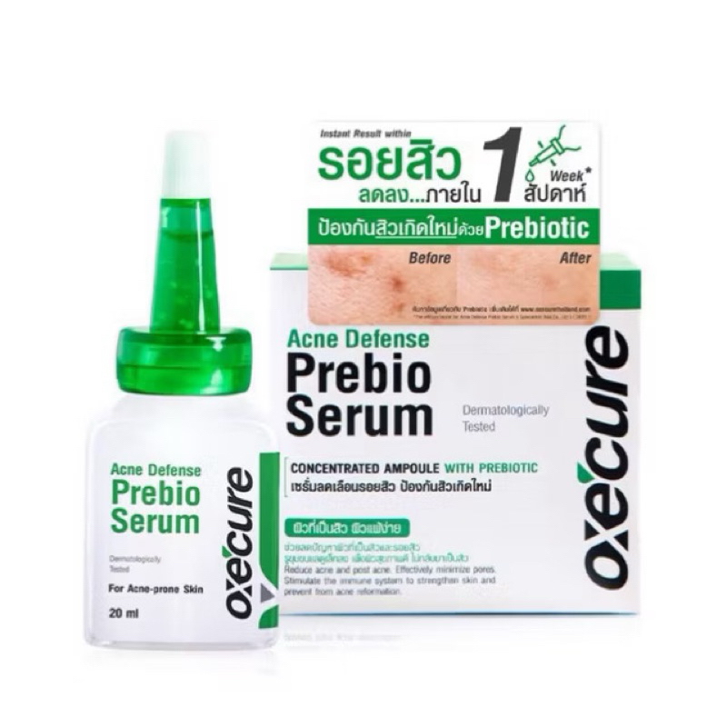 Gallery Detail: Acne Scars Reduce Quickly Oxecure Prebio Serum 20 Ml Acne