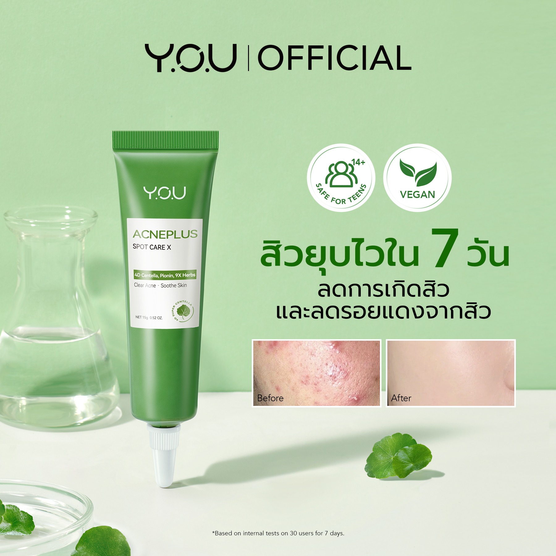YOU BEAUTY-Acneplus Spot Care X (15g.) Y Ou Acne Plus X Scars | Shopee ...