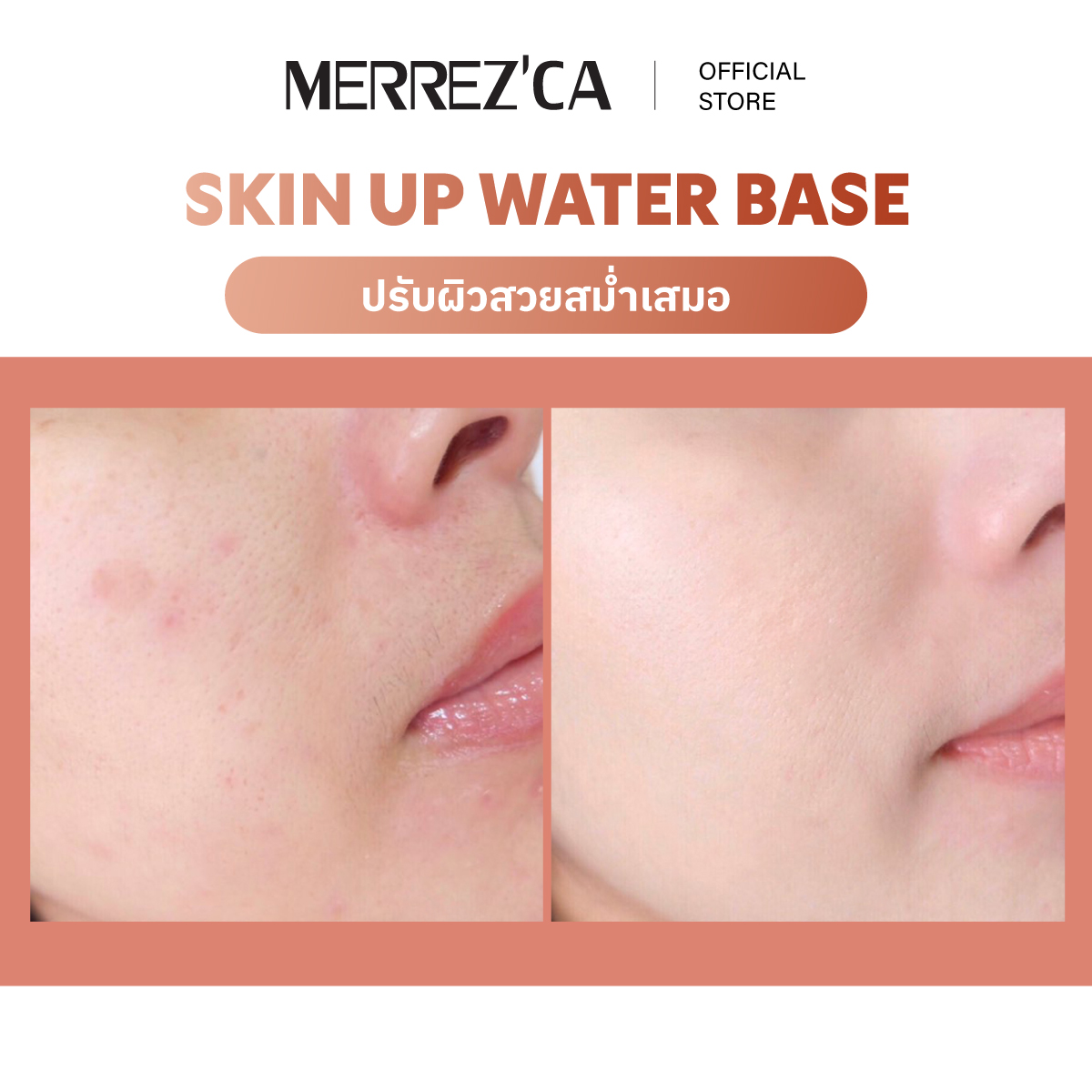 (1&3 Sachets) Merrezca Skin Up Water Base- Sachet A Water-Based Base ...