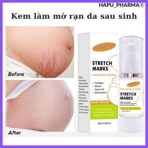 Stretch Marks Cream Stretch Marks Cream Helps To Fade Stretch Marks