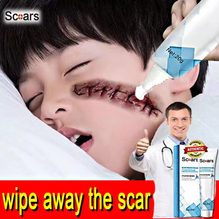 Shea Butter Intensive Scar Removal Cream Removes Keloids, Concave Scars