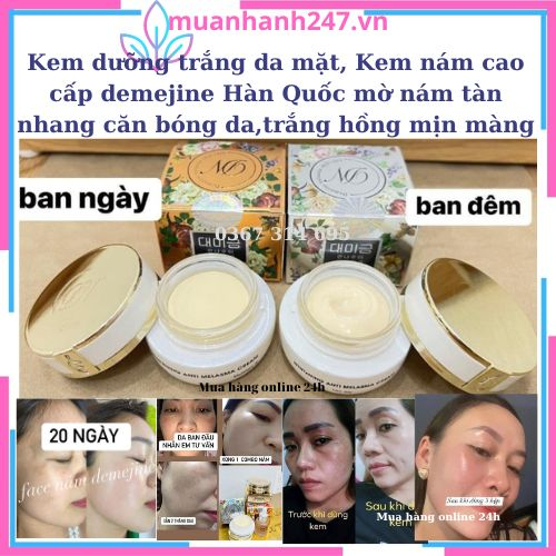 Facial Whitening Cream, Slingshotm Premium Korean demejine Cream Matte ...