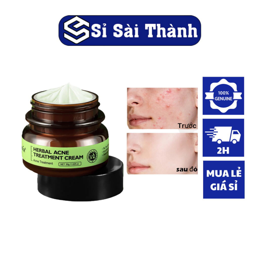 Vibrant GLAMOUR Herbal Acne Treatment Cream 30g | Shopee Malaysia