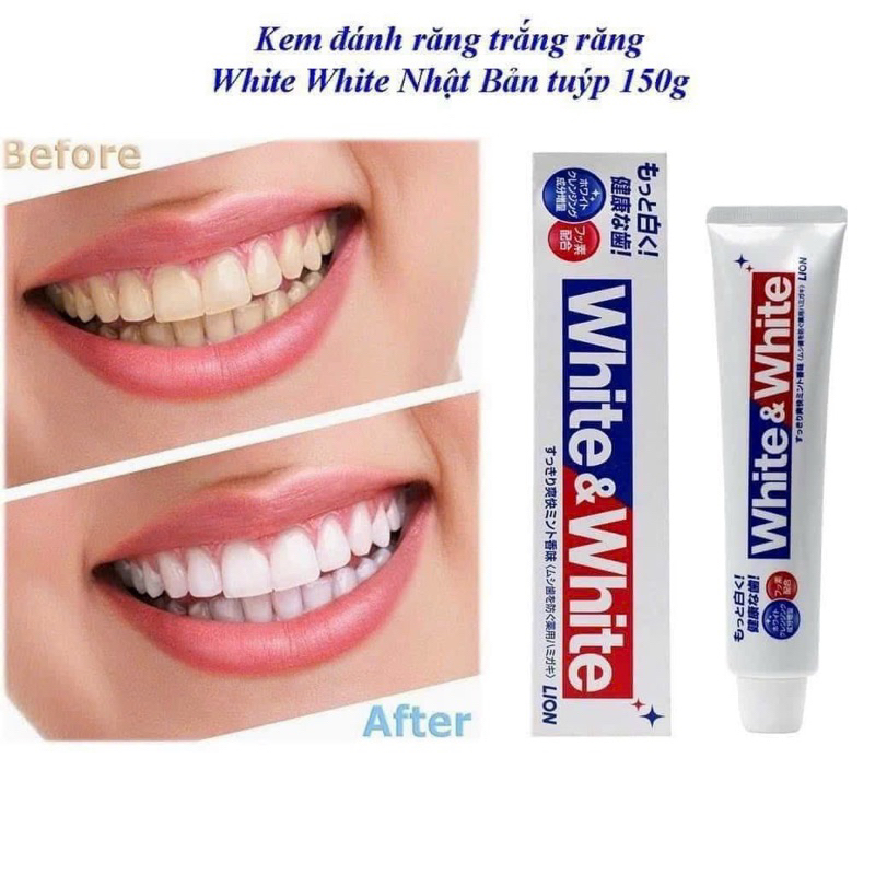 White toothpaste 150g | Shopee Malaysia