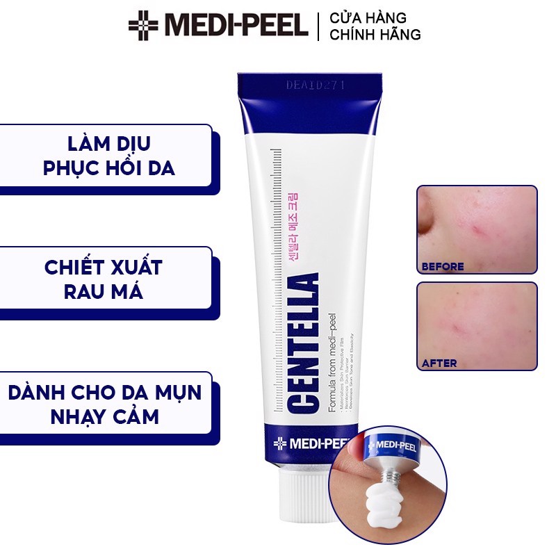 Medi-peel Centella Divine Acne Reduction Cream 30ml Korea reduces ...