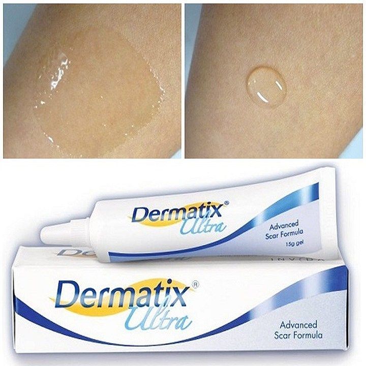 Dermatix Ultra Scarring Cream Helps To Flatten Keloids, Concave, Dark
