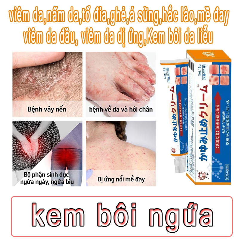 Kobayashi, Urticaria Instant Relief Cream, Rashes, Jaundice And Cement