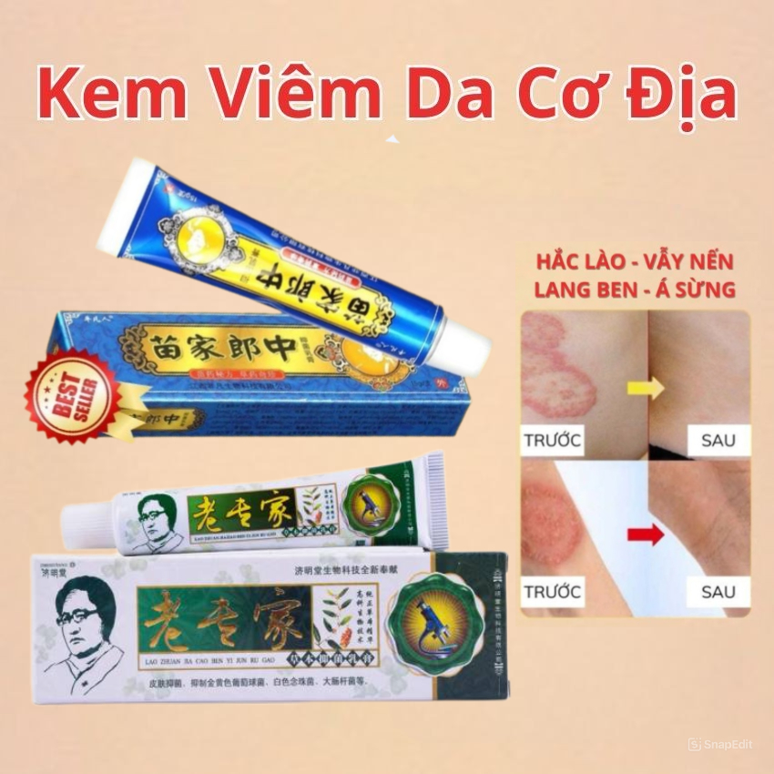 Cream for Atopic Dermatitis, Ringworm, Ringworm, Insect Bites, Skin ...