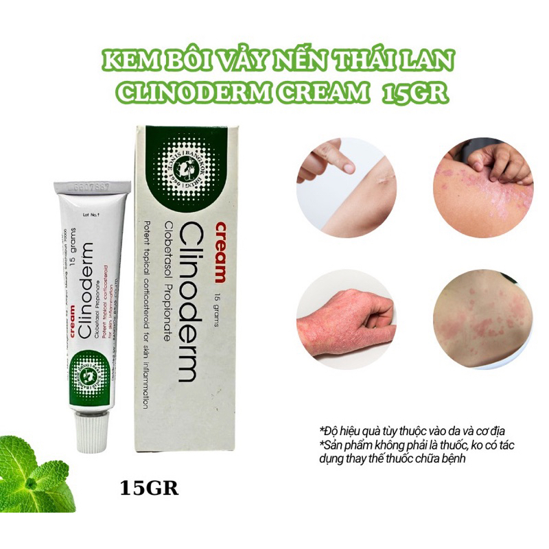 Thai Psoriasis Itching Cream Clinoderm Cream 15g - Support Atopic ...