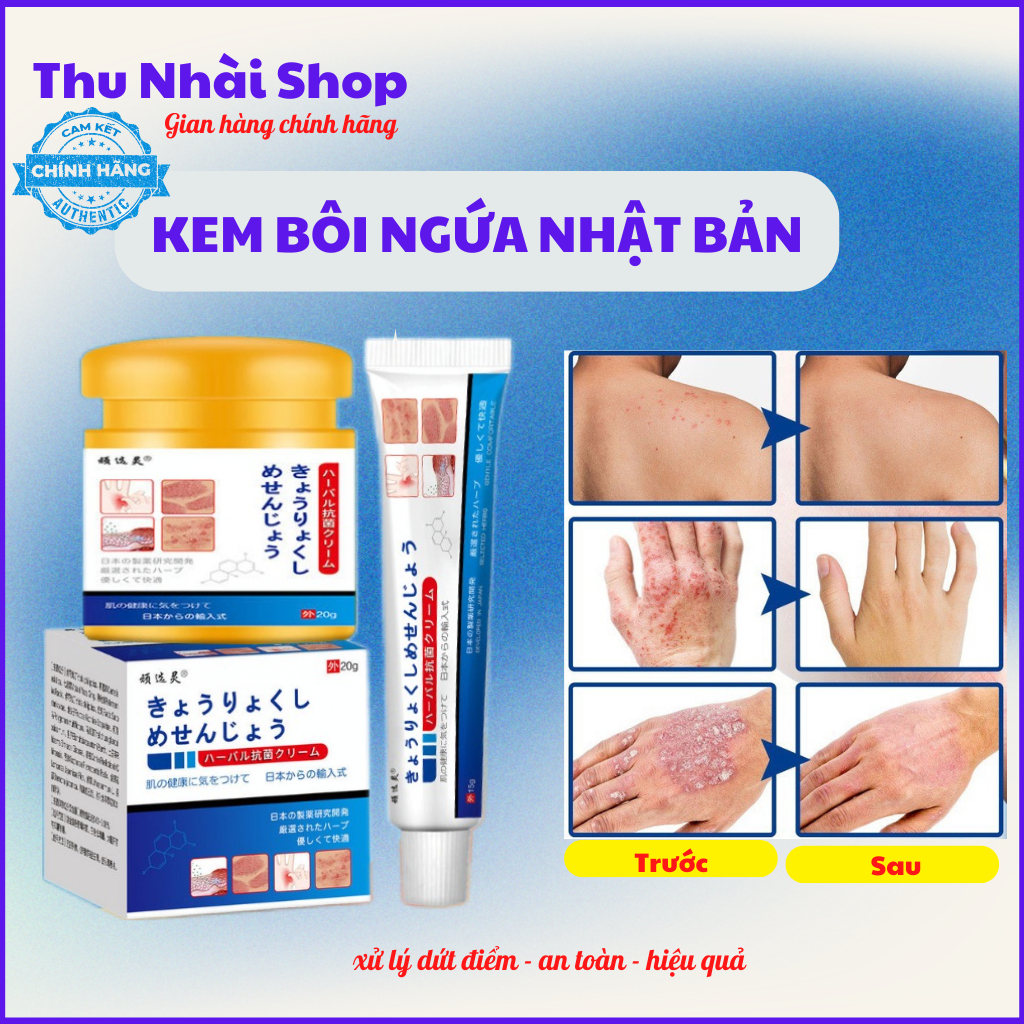 Japanese Atopic Dermatitis Cream - Effectively Helps Eliminate Ringworm ...