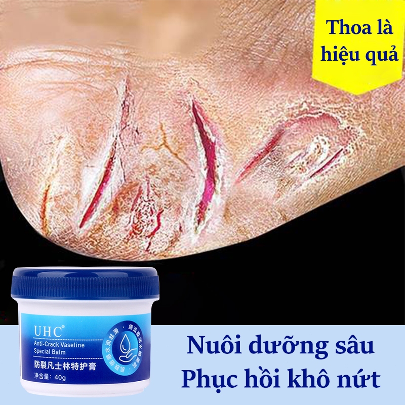 Heel cream cracked heel cream heel cream 40g Moisturizing Anti-Chapped ...