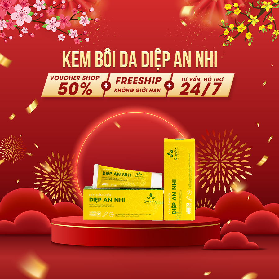Diep An Nhi diaper cream - Supports the treatment of diaper rash ...