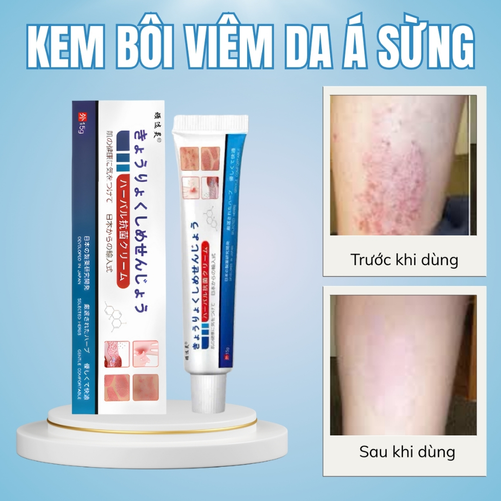 Cream for Asian Keratosis Dermatitis, Itching, Swelling and Redness ...